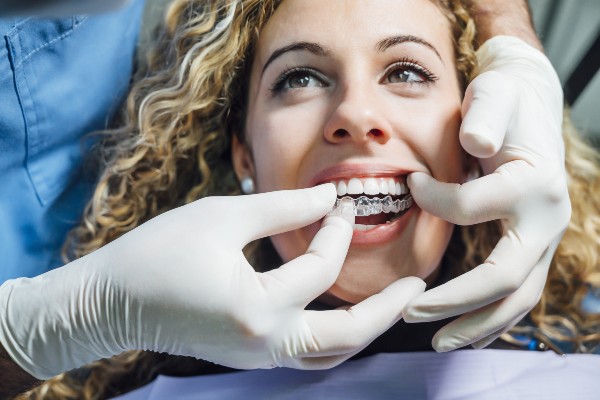 invisalign