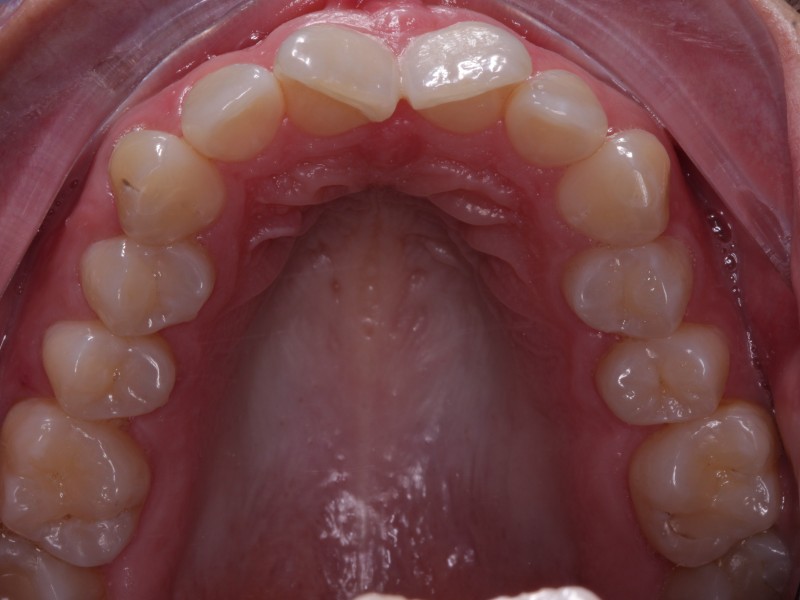 Before