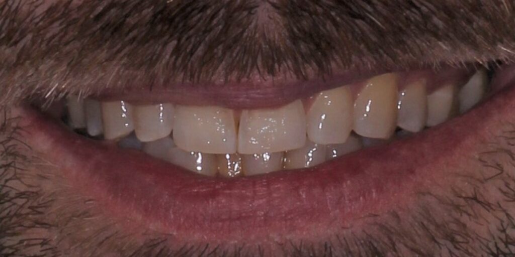 Before