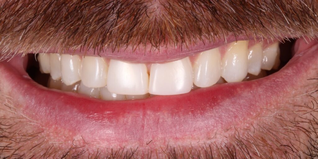 After
